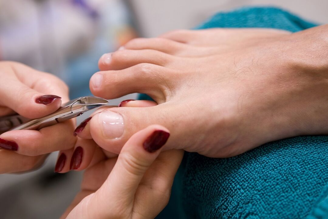 pedicure as a way to get infected with nail fungus