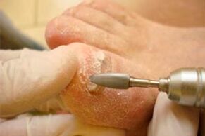 Mechanical nail cutting