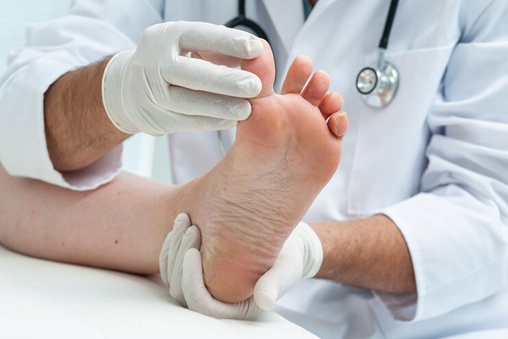 The dermatologist examines the patient's feet