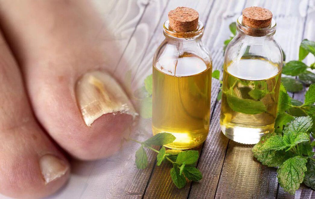 nail fungus vinegar